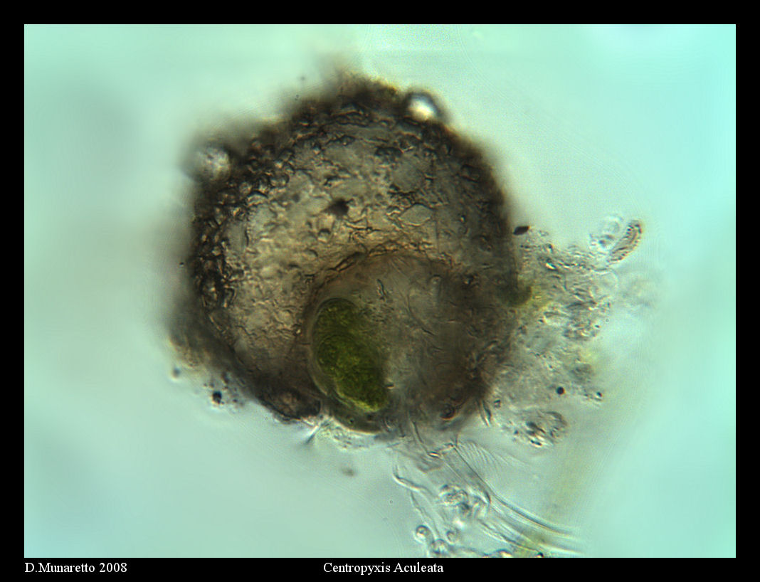 Centropyxis Aculeata